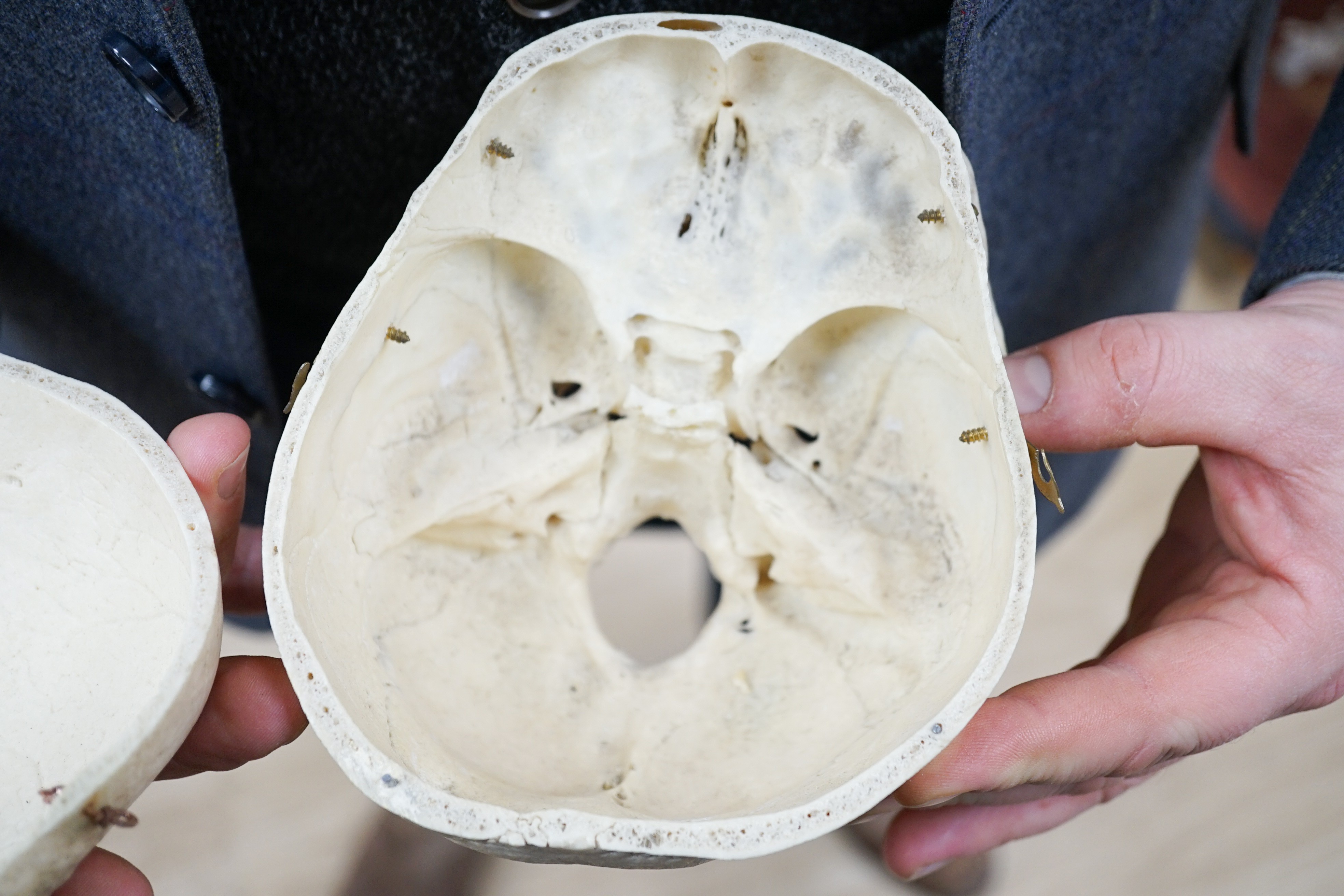 A human skull with removable cranium and spring loaded jaw 15.5cm